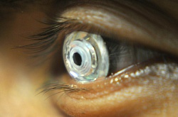 Ученые создали контактные линзы с двойным зумом